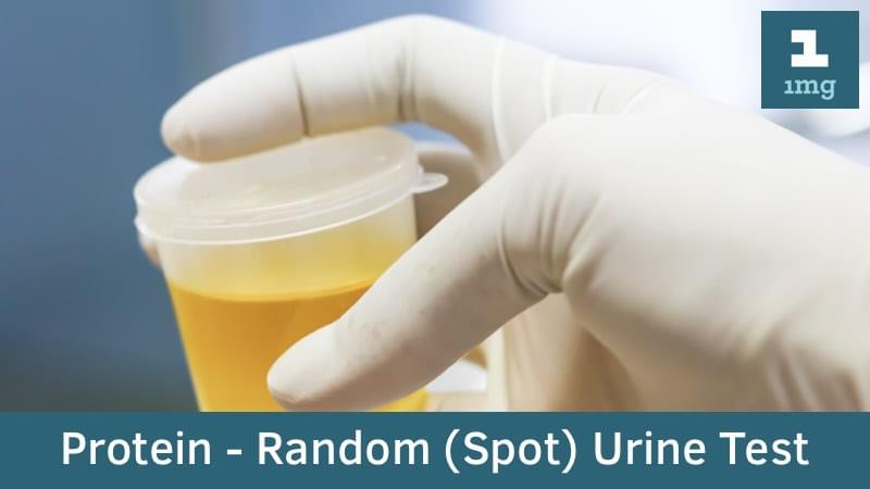 Protein - Random (Spot) Urine