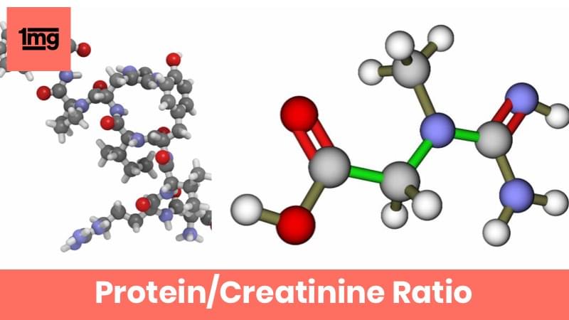Protein/Creatinine Ratio