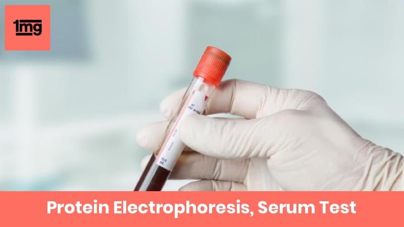 Protein Electrophoresis, Serum