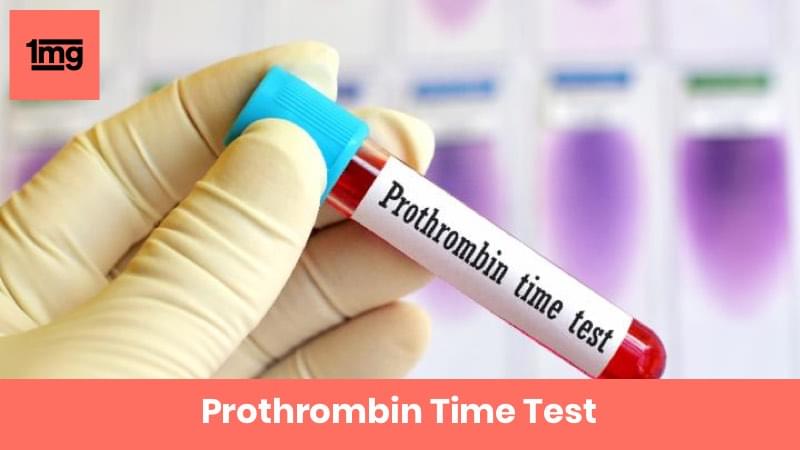 Prothrombin Time In New Delhi From Dr. Lal PathLabs Ltd.: View Price ...