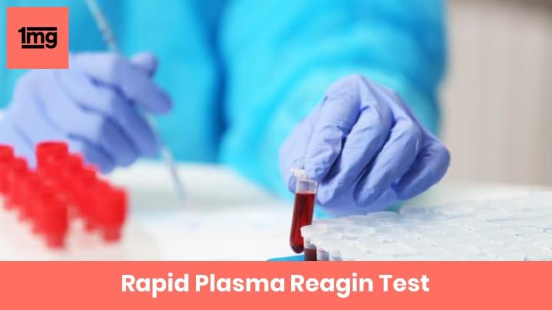 Rapid Plasma Reagin