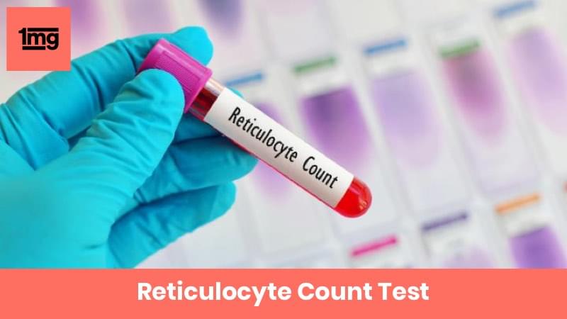 Reticulocyte Count