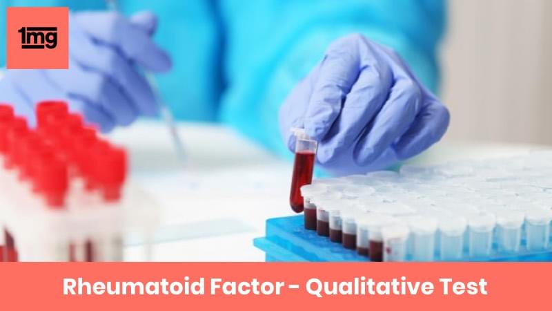 Rheumatoid Factor - Qualitative