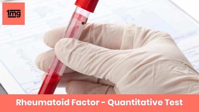 Rheumatoid Factor - Quantitative