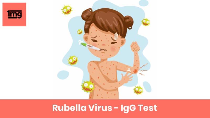 Rubella Virus - IgG
