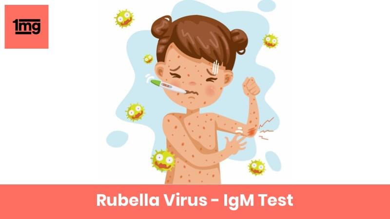 Rubella Virus - IgM