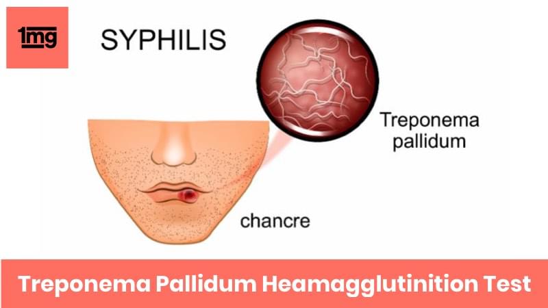Treponema Pallidum Hemagglutination