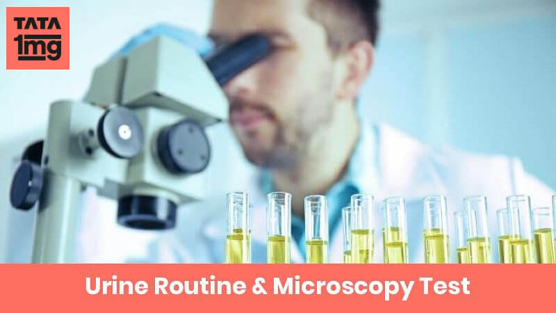 Urine Routine Microscopy Urine R M Purpose Normal Range Of Results 1mg