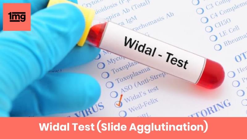 Widal Test (Slide Agglutination)