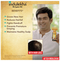 Indulekha Hair Oil thumbnail