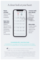AliveCor KardiaMobile 6L ECG Monitor thumbnail