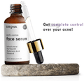 Sirona Anti-Acne Face Serum thumbnail