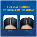 Scalpe+ Expert Anti Dandruff Shampoo thumbnail