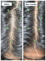 Oziva Combo Pack of Hair Vitamins Capsule (60 Each) thumbnail