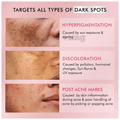 mCaffeine 2% Kojic Acid & 1% Niacinamide De Pigmentation Cream thumbnail