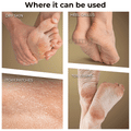 Winston Callus Remover thumbnail