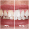 Coco Crush Teeth Whitening Liquid thumbnail