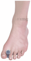 Vissco Toe Spreader thumbnail