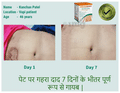 Vedangah Anti Fungal Cream (12gm Each) thumbnail