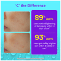 Chemist At Play 10% Vitamin C+2% Glucosamine+Ceramide Brightening Face Serum thumbnail