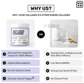 What's Up Wellness Anti-Acne Titagen Marine Collagen Type I & III Black Currant thumbnail