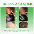 Pureauty Naturals Biotin Hair Serum Advanced Formula thumbnail
