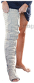 Thuasne Mobiderm Autofit Full Leg Compression Garment Size 5 thumbnail