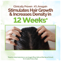 Mamaearth Rosemary Hair Growth Scalp Serum thumbnail