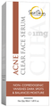 Seriskin Acne Clear Face Serum thumbnail