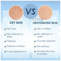 Cetaphil Optimal Hydration Daily Cream thumbnail