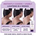 Sanfe Spotlite Insta-Cover Body Lightening Cream for Dark Neck, Joints and Skinfolds SPF 30 thumbnail