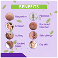Achal Radha Malham Effective Skin Relief for Eczema, Ringworm, and Itching (75gm Each) thumbnail
