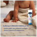 Cetaphil Baby Diaper Cream with Natural Chamomile | For Baby's Sensitive Skin thumbnail