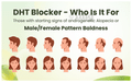 Sprowt DHT Blocker Capsule (60 Each) thumbnail