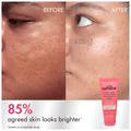 mCaffeine 2% Kojic Acid & 1% Niacinamide De Pigmentation Cream thumbnail