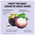 What's Up Wellness Anti-Acne Titagen Marine Collagen Type I & III Black Currant thumbnail