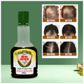 Action Pharma Kesh Amrit Ganjnashk Oil thumbnail