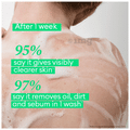 Dove Acne Clear Body Wash thumbnail