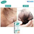 West-Coast Cradnil Cradle Cap Shampoo thumbnail