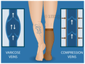 BN-VARICO 100 Medical Compression Stockings Knee Length Beige XL thumbnail