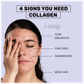 What's Up Wellness Anti-Acne Titagen Marine Collagen Type I & III Black Currant thumbnail