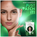 Urban Yog Acne/Pimple 36 Dots Patch thumbnail