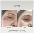The Formularx Vitamin C Arbutin N-acetylglucosamine Serum thumbnail