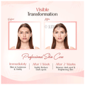 VCare Facial Cream thumbnail