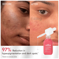 mCaffeine 3% Tranexamic,2% Alpha Arbutin Advanced Pigmentation Serum thumbnail