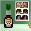 Action Pharma Kesh Amrit Ganjnashk Oil thumbnail