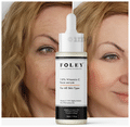 Foley 10% Vitamin C Face Serum (30ml Each) thumbnail
