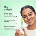 Foxtale One Zit Wonder Acne Spot Corrector Gel | With AHA & BHA for All Skin Types thumbnail