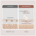 Areoveda Cellular Skin Science Bullet Coffee Stretch Marks Cream (25gm Each) for All Skin Types thumbnail
