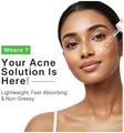 Smlkh Salicylic Acid Face Serum For Pimple & Acne Care Formula | Best for Oily Skin (15 Each) thumbnail